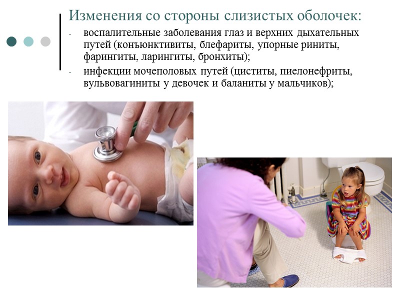 Изменения со стороны слизистых оболочек:  воспалительные заболевания глаз и верхних дыхательных путей (конъюнктивиты,